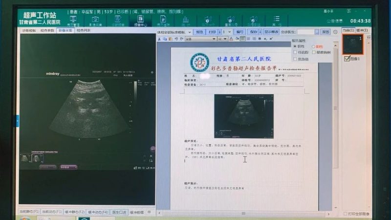 女性体检报告中的“激素六项”揭秘：关键指标与解读**